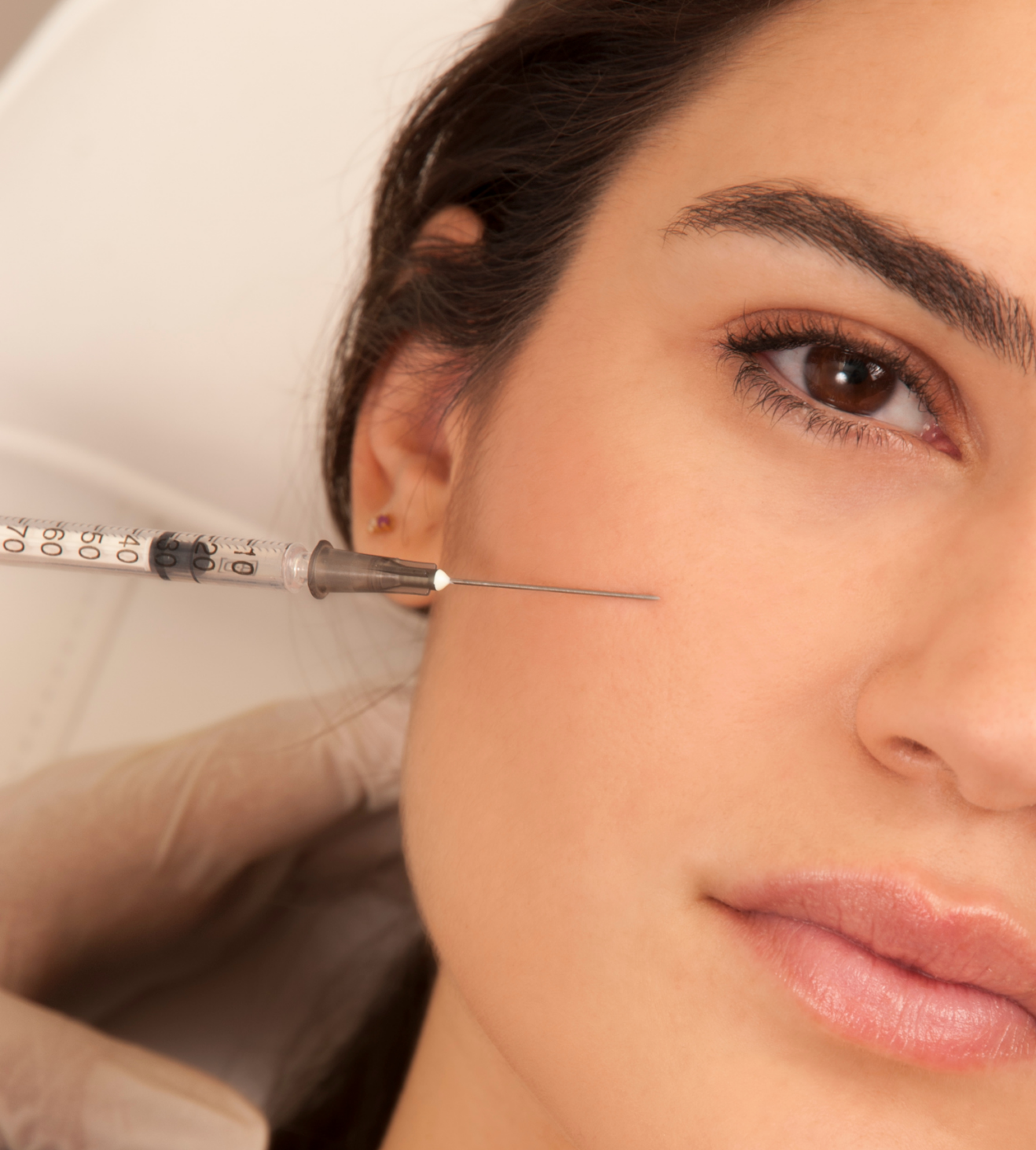 sculptra before and after